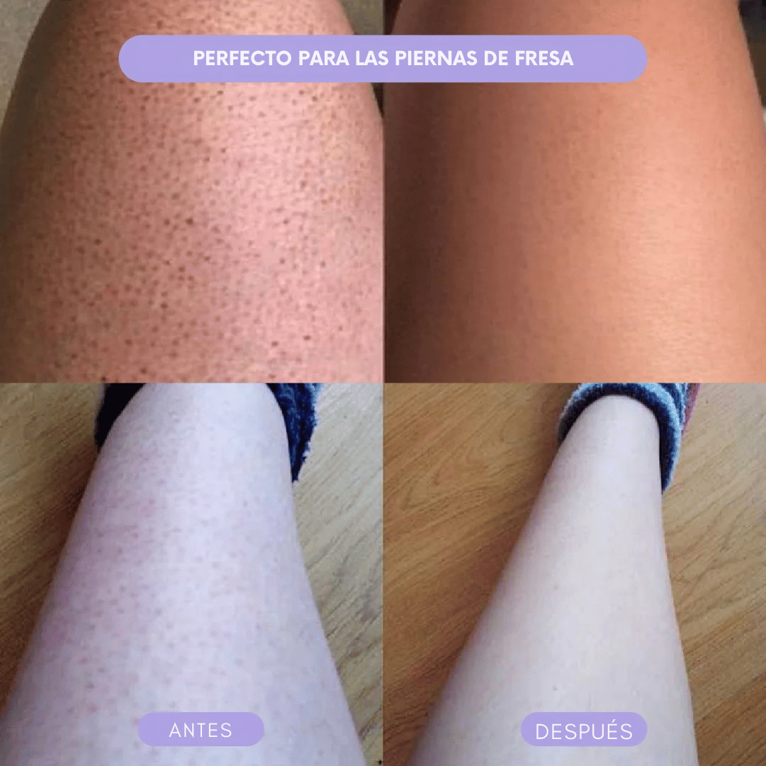 LUMMISILK™| Depilador de cristal